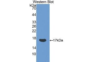 Western blot analysis of the recombinant protein. (Ribonuclease A8 anticorps  (AA 19-154))