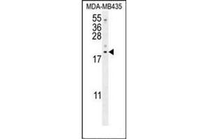 Western blot analysis of LYRM4 Antibody (Center) in MDA-MB435 cell line lysates (35ug/lane).