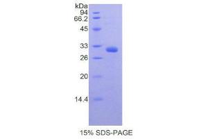 SDS-PAGE (SDS) image for Myosin IA (MYO1A) (AA 783-1043) protein (His tag) (ABIN2121680) (Myosin IA Protein (MYO1A) (AA 783-1043) (His tag))