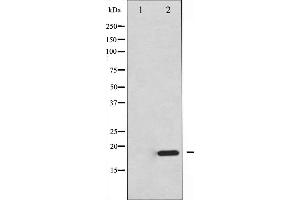 Western blot analysis of 4E-BP1 expression in EGF treated MDA-MB-435 whole cell lysates,The lane on the left is treated with the antigen-specific peptide. (eIF4EBP1 anticorps  (Internal Region))