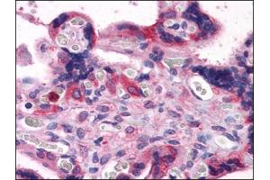 Immunohistochemistry Image: Human Placenta: Formalin-Fixed, Paraffin-Embedded (FFPE) (BAG3 anticorps  (C-Term))
