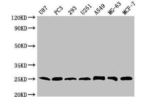 Western Blot Positive WB detected in: U87 whole cell lysate, PC-3 whole cell lysate, 293 whole cell lysate, U251 whole cell lysate, A549 whole cell lysate, MG-63 whole cell lysate, MCF-7 whole cell lysate All lanes CD9 antibody at 1:2000 Secondary Goat polyclonal to mouse IgG at 1/50000 dilution Predicted band size: 25 KDa Observed band size: 25 KDa Exposure time: 5 min (CD9 anticorps  (AA 112-195))