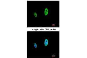 ICC/IF Image Immunofluorescence analysis of paraformaldehyde-fixed HeLa, using TIMELESS, antibody at 1:500 dilution.