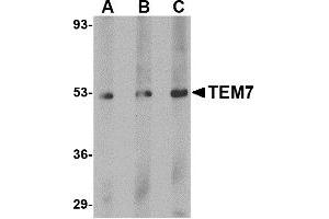 Image no. 1 for anti-Plexin Domain Containing 1 (PLXDC1) (C-Term) antibody (ABIN203738) (PLXDC1 anticorps  (C-Term))