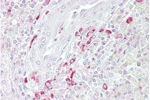 Immunohistochemistry with Spleen tissue at an antibody concentration of 5µg/ml using anti-FRZB antibody (ARP54571_P050) (FRZB anticorps  (Middle Region))
