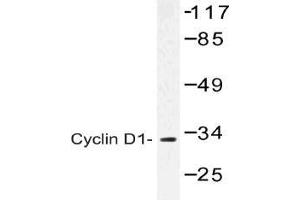 Western blot (WB) analysis of Cyclin D1 antibody in extracts from K562 cells.