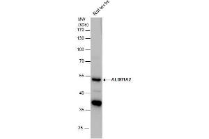 WB Image ALDH1A2 antibody detects ALDH1A2 protein by western blot analysis.