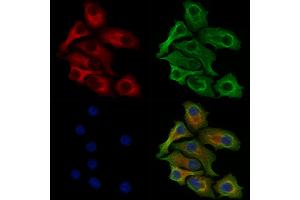 Phospho-EPRS (Ser886) Antibody staining Hela cells(heat shock treatment) by IF/ICC. (EPRS anticorps  (pSer886))