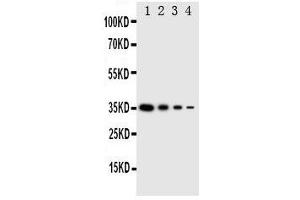 Western Blotting (WB) image for anti-Eukaryotic Translation Initiation Factor 2 alpha Kinase 4 (EIF2AK4) (AA 868-886), (Middle Region) antibody (ABIN3044057)