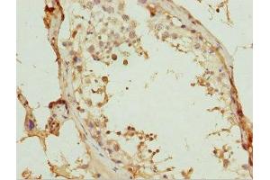 Immunohistochemistry of paraffin-embedded human testis tissue using ABIN7175755 at dilution of 1:100 (WDR47 anticorps  (AA 350-600))