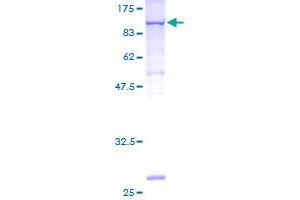 SDS-PAGE (SDS) image for Vascular Cell Adhesion Molecule 1 (VCAM1) (AA 1-739) protein (GST tag) (ABIN1324937)