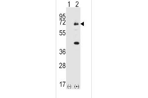 Western blot analysis of SYK (arrow) using rabbit polyclonal SYK Antibody  (ABIN6243735 and ABIN6579008).