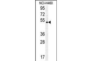 Western blot analysis in NCI-H460 cell line lysates (35ug/lane). (DENND1B anticorps  (N-Term))