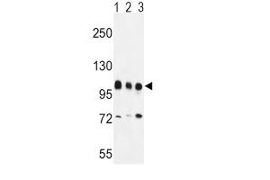 Western Blotting (WB) image for anti-Enhancer of Zeste Homolog 2 (EZH2) antibody (ABIN3001535) (EZH2 anticorps)
