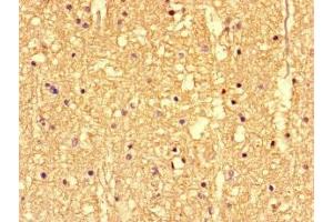 Immunohistochemistry of paraffin-embedded human brain tissue using ABIN7146400 at dilution of 1:100 (SS18L1 anticorps  (AA 47-396))