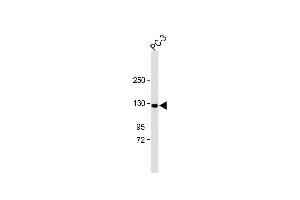 All lanes : Anti-TR Antibody (C-term ) at 1:1000 dilution Lane 1: PC-3 whole cell lysate Lysates/proteins at 20 μg per lane.