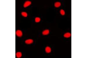 Immunofluorescent analysis of GADD153 staining in Jurkat cells. (DDIT3 anticorps  (N-Term))