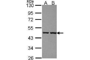 WB Image Sample (30 ug of whole cell lysate) A: 293T B: A431 , 10% SDS PAGE antibody diluted at 1:1000 (ZNF396 anticorps)