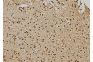 ABIN6276672 at 1/100 staining Mouse brain tissue by IHC-P. (PTPN22 anticorps  (C-Term))
