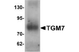 Western blot analysis of TGM7 in human lung tissue lysate with TGM7 Antibody  at 1 μg/ml. (Transglutaminase 7 anticorps  (Middle Region))