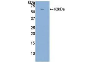 Detection of Recombinant ACE, Human using Polyclonal Antibody to Angiotensin I Converting Enzyme (ACE)