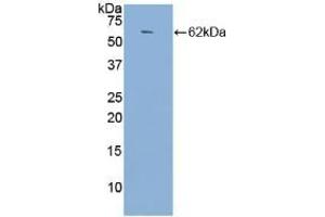 Detection of Recombinant ACE, Human using Polyclonal Antibody to Angiotensin I Converting Enzyme (ACE) (Angiotensin I Converting Enzyme 1 anticorps  (AA 814-1071))