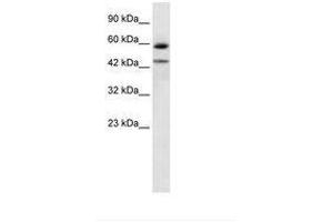 Image no. 1 for anti-Thyroid Hormone Receptor, alpha (THRA) (AA 246-295) antibody (ABIN6735941) (THRA anticorps  (AA 246-295))