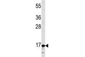 CGRP antibody western blot analysis in CEM lysate (CGRP anticorps  (AA 56-84))