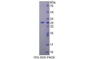SDS-PAGE (SDS) image for Ribonuclease L (2',5'-Oligoisoadenylate Synthetase-Dependent) (RNASEL) (AA 358-583) protein (His tag) (ABIN1099436)