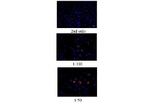 MCF-7 cells were labeled with BrdU (10μM) and stained with mouse monoclonal antibody against BrdU with dilution at 1:100 and 1:50.