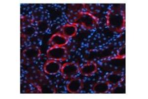 Immunofluorescent TGFB1 detection in mouse kidney (red fluorescence).