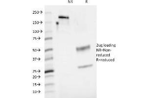 SDS-PAGE Analysis Purified CD48 Mouse Monoclonal Antibody (5-4. (CD48 anticorps)