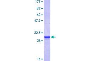 Image no. 1 for Corneodesmosin (CDSN) (AA 306-355) protein (GST tag) (ABIN1349047)
