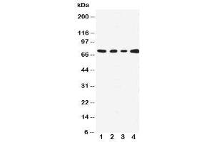 Western blot testing with MEKK3 antibody;  Lane 1: HeLa;  2: A431;  3: MCF-7;  4: Jurkat cell lysate.