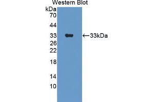 Western blot analysis of the recombinant protein. (ERBB3 anticorps  (AA 707-964))