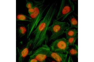 Immunofluorescence (IF) image for anti-Bromodomain Containing 4 (BRD4) (AA 1312-1362) antibody (ABIN7454019)