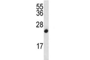 CDKN2B antibody western blot analysis in CEM lysate (CDKN2B anticorps  (AA 103-131))