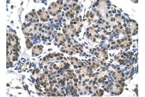 DHX9 antibody was used for immunohistochemistry at a concentration of 4-8 ug/ml to stain Epithelial cells of pancreatic acinus (arrows) in Human Pancreas.