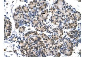 DHX9 antibody was used for immunohistochemistry at a concentration of 4-8 ug/ml to stain Epithelial cells of pancreatic acinus (arrows) in Human Pancreas. (DHX9 anticorps)