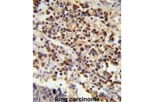 Immunohistochemistry (IHC) image for anti-U2 Small Nuclear RNA Auxiliary Factor 1 (U2AF1) antibody (ABIN3001639) (U2AF1 anticorps)