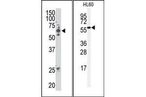 Image no. 1 for anti-SUMO1/sentrin/SMT3 Specific Peptidase 2 (SENP2) (C-Term) antibody (ABIN356752)