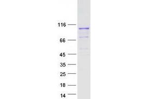 Validation with Western Blot