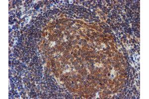 Image no. 4 for anti-RuvB-Like 2 (E. Coli) (RUVBL2) (AA 113-370) antibody (ABIN1490851)