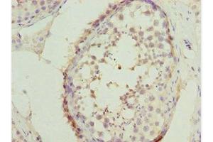 Immunohistochemistry of paraffin-embedded human testis tissue using ABIN7171132 at dilution of 1:100 (SYCE1 anticorps  (AA 132-351))
