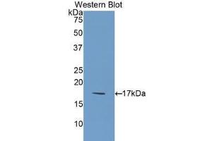 Western blot analysis of the recombinant protein. (FIL1d anticorps  (AA 12-151))