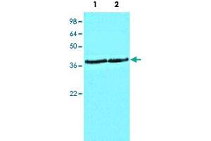 Cell lysates of HeLa (Lane 1) and MCF-7 (Lane 2) (40 ug/lane) were resolved by SDS-PAGE, transferred to NC membrane and probed with CSNK1A1 monoclonal antibody, clone AT2E2  (1 : 1000). (CSNK1A1 anticorps)