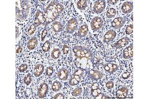 IHC analysis of ECSIT using anti-ECSIT antibody (ABIN7602543).