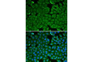 Immunofluorescence analysis of HeLa cells using SPINK1 antibody. (SPINK1 anticorps)