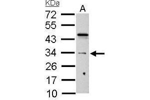 WB Image HUS1 antibody detects HUS1 protein by Western blot analysis. (HUS1 anticorps  (Center))