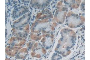 DAB staining on IHC-P; Samples: Human Stomach Tissue (FLG2 anticorps  (AA 1915-2143))